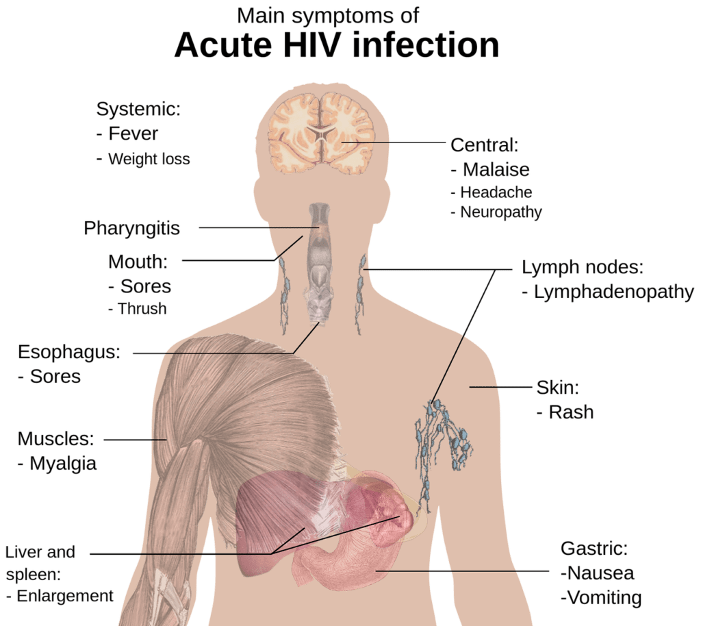 Abacavir symptoms