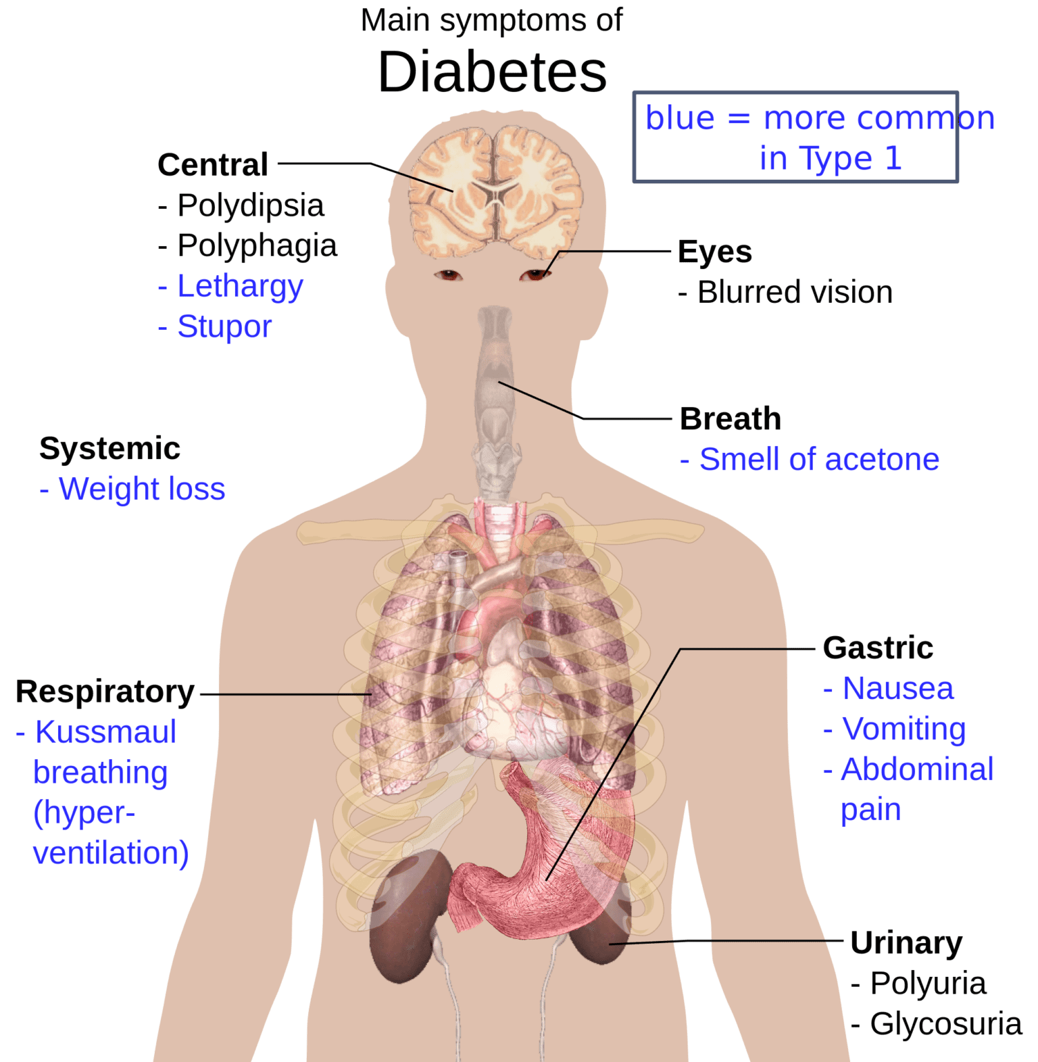 diabetes-mellitus-everything-you-need-to-know-meditechtips